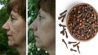 Mix cloves with water to look 10 years younger than your age! Natural Botox ! with carnations