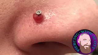 Piercing Bumps - Everything You Need To Know