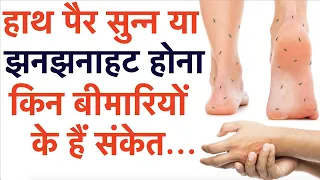 हाथ पैर सुन्न, सोना या झनझनाहट होना किन बीमारियों के हैं संकेत || Numbness in feet or hands