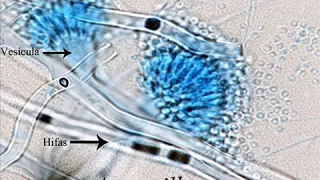 Técnicas básicas de microbiología: Tinción de hongos con Azul de Lactofenol