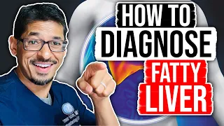 How to DIAGNOSE FATTY Liver | Fatty Liver Disease | Sameer Islam Videos