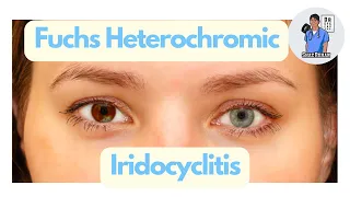 Fuchs Heterochromic Iridocyclitis (FHC) - What is this fascinating condition? Eye Dr Explains, 2023