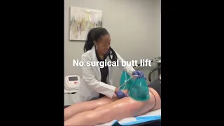 Lift your butt without surgery! Vacuum Butt Lift Body Contouring