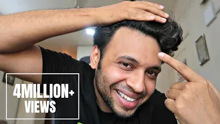 HOW I STOPPED MY HAIR FALL | क्या आपके बाल झड़ते है ? ज़रूर देखिये | @UrIndianConsumer