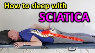 10 Ways To Sleep Better With SCIATICA & LOW BACK PAIN