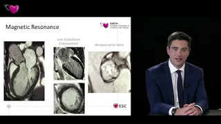 EACVI free webinar: How to use imaging for transcatheter interventions? (II)