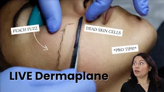 LIVE DERMAPLANE Q&A WITH MASTER AESTHETICIAN | #Skincare