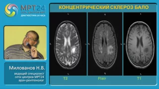 «Дифференциальная диагностика очаговых и объемных изменений головного мозга»