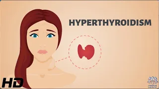 HYPERTHYROIDISM: Everything You Need To Know