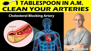 1 TABLESPOON IN A.M. CLEAN YOUR ARTERIES, PREVENT HEART ATTACK & STROKE - Dr Alan Mandell, DC
