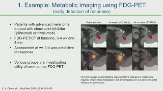 Visualizing Tumor Immunity and Response