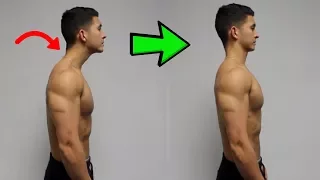 FIX Forward Head Posture! (Daily Corrective Routine)