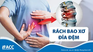 RÁCH BAO XƠ ĐĨA ĐỆM & NGUY CƠ  GÂY THOÁT VỊ ĐĨA ĐỆM - NGUYÊN NHÂN VÀ CÁCH PHÒNG NGỪA