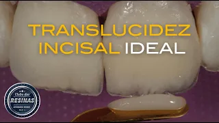 Translucidez incisal ideal