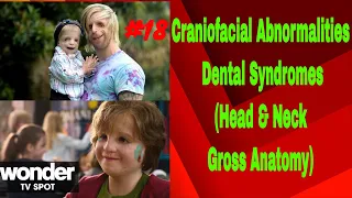 Craniofacial & Dental Syndromes (INBDE- Dental Boards)