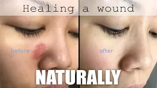 Healing a face wound naturally