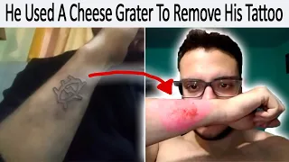 r/AwfulEverything | Cheese Grating Arm To Remove Tattoo