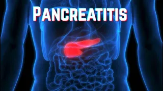 Pancreatitis - CRASH! Medical Review Series