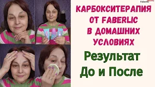 Карбокситерапия от Faberlic. Как не состариться раньше времени.