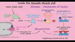 Nitroglycerin Mechanism of Action for Angina Pectoris