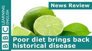 Poor diet brings back historical disease: BBC News Review