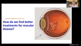 Macular Research Info Session 2023