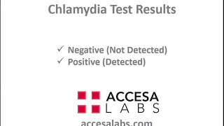 Chlamydia Test Results Overview