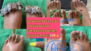 How to remove/soak off Gel nail polish from toes at home(Quick & Easy!!)