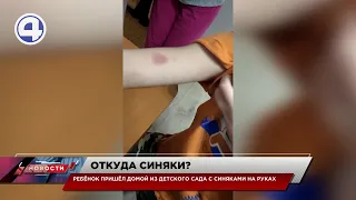 Избили ребенка в детском саду? / Свердловская область