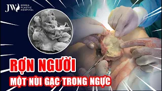 Bác sĩ Tú Dung SỐC TOÀN TẬP vì SPA BỎ QUÊN miếng GẠC Y TẾ SIÊU TO, TANH HÔI trong ngực khách