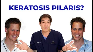 Keratosis Pilaris | How to treat by dermatologist Dr Davin Lim
