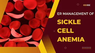 Sickle Cell Anemia || Sickle cell crisis