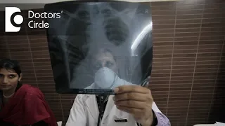 Is Tuberculosis contagious  how does it spread? - Dr. Hirennappa B Udnur