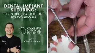 Dental Implant Suturing: Techniques, Materials, and Tips for Success