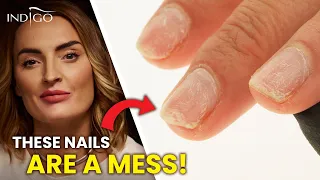 These NAILS are a MESS! – a repair of a damaged nail step by step | Indigo Nails