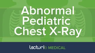 Abnormal Chest Findings in Pediatric Radiology