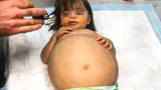 This Baby's Belly Kept Growing Nonstop, Then The Doctors Delivered The Alarming News To Her Parents