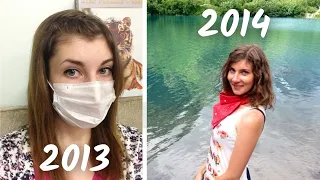 ALMOST DIED AT 23. Sick with tuberculosis for a year. Story in Russian with English subtitles. B1+