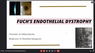 Fuch's Endothelial Dystrophy, Dr Alekya Marella, 30 June, 2021