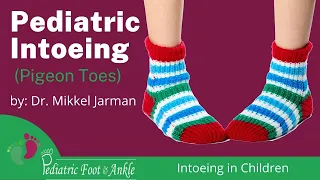 Pediatric Intoeing (Pigeon Toes) Intoeing in Children