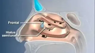 Anatomy of the Nasal Cavity.mov