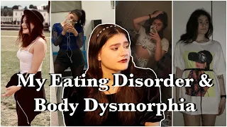 My Life with an Eating Disorder & Body Dysmorphia  * how it ruined my favourite thing in the world*