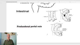 Paediatric surgery in Arabic 5 ( Congenital duodenal Obstruction) ,  by Dr, Wahdan