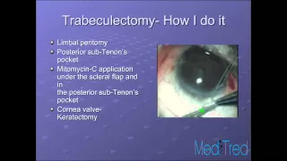 Glaucoma Lecture Series 7: Trabeculectomy