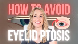 How to Correct Eyelid Ptosis after Botox | How to Avoid it in the First Place