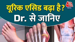 जाने क्या यूरिक एसिड बढ़ हुआ है. Uric Acid| Ortho| Joint Pain|