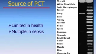 SEPSIS - Advances In The Early Detection and Management of Sepsis | US