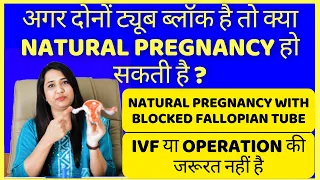 दोनों ट्यूब ब्लॉक है तो क्या NATURAL PREGNANCY हो सकती है ?  PREGNANCY WITH BLOCKED FALLOPIAN TUBE