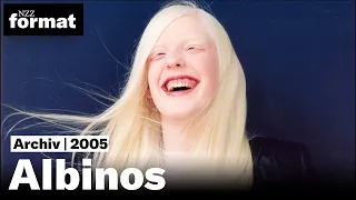 Albinos - Dokumentation von NZZ Format (2005)