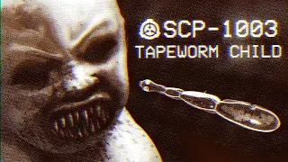 SCP-1003 - Tapeworm Child : Object Class - Keter :  Parasitic SCP